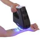 Shape Tactics 308nm Excimer Laser System