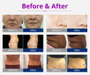 Shape Tactics 6-in-1 2.0 Cavitation 40K LED Radio Frequency