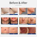 Shape Tactics 8-in-1 Cavitation RF Bio Hot/Cold Hammer Device