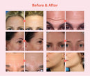 Shape Tactics Diamond Dermabrasion Bio Micro Photon Ultrasonic Machine
