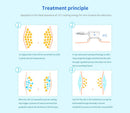Dispositivo de adelgazamiento por vacío con congelación de grasa y criolipólisis de doble mango Shape Tactics