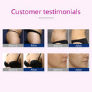 Shape Tactics - Microcurrent Electrode Stimulation Body Shaping Machine