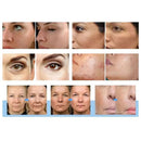 Shape Tactics - Morpheus 3-in-1 Gold RF Skin Lift & Cold Hammer System