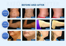 Shape Tactics Cryolipolysis Vacuum Slimming & Double Chin Removal Machine