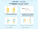 Shape Tactics Cryolipolysis Vacuum Slimming & Double Chin Removal Machine
